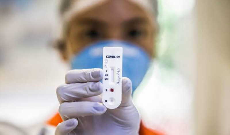 Imagem destaque notícia ARAPORÃ INICIA TESTAGEM PARA ATINGIR 30% DA POPULAÇÃO